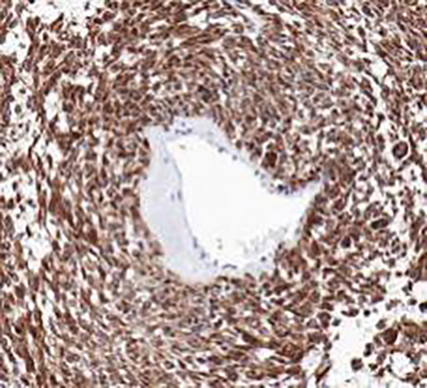 CEA Recombinant Rabbit Monoclonal Antibody (clone BP6085)