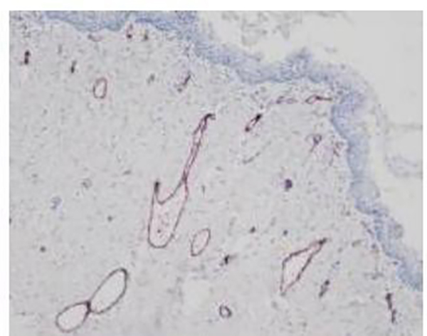 Calponin Recombinant Rabbit Monoclonal Antibody (clone BP6093)