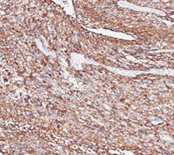 CD56 Recombinant Rabbit Monoclonal Antibody (clone BP6156)