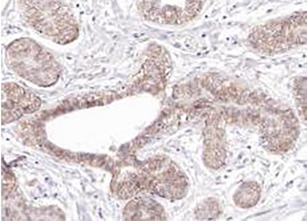 CD45 Recombinant Rabbit Monoclonal Antibody (clone BP6073)