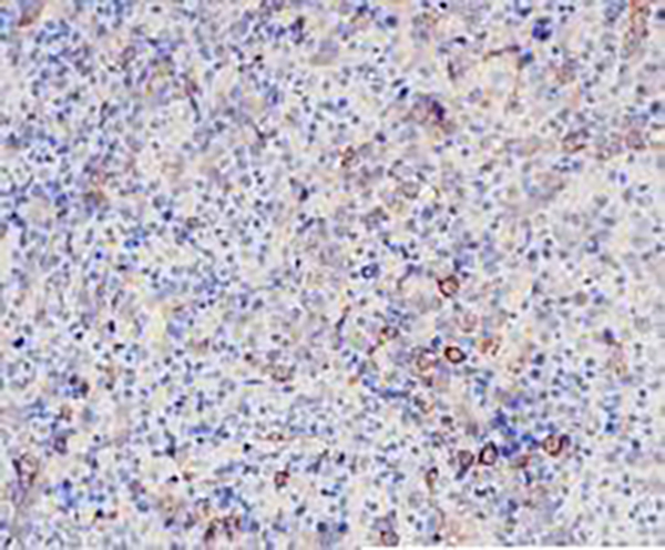 BCMA Recombinant Rabbit Monoclonal Antibody (clone BP6211)