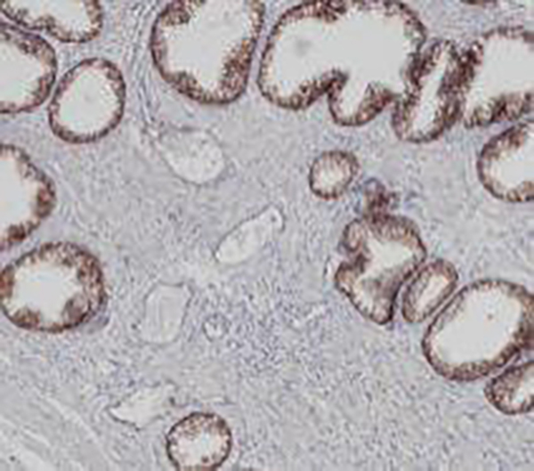 Beta-Catenin Recombinant Rabbit Monoclonal Antibody (clone BP6159)