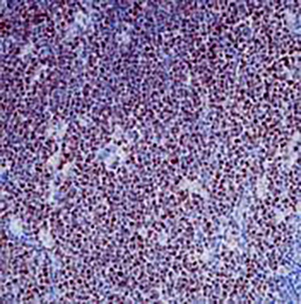 Bcl-6 Recombinant Rabbit Monoclonal Antibody (clone BP6216)