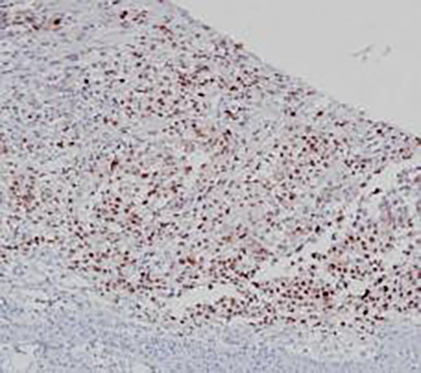 PRAME Recombinant Rabbit Monoclonal Antibody (clone BP6248)
