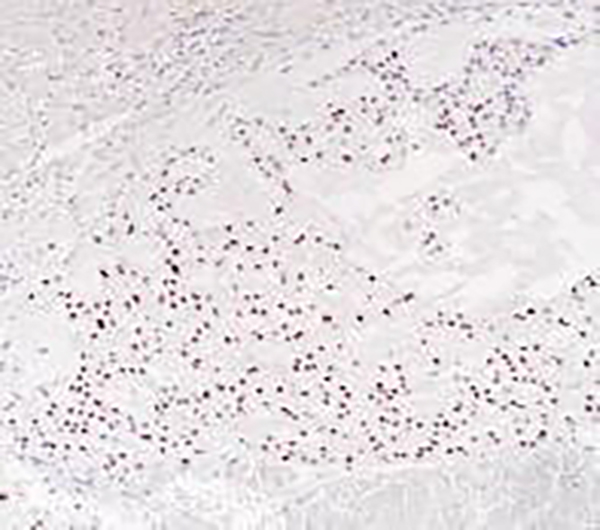Brachyury Recombinant Rabbit Monoclonal Antibody (clone BP6218)