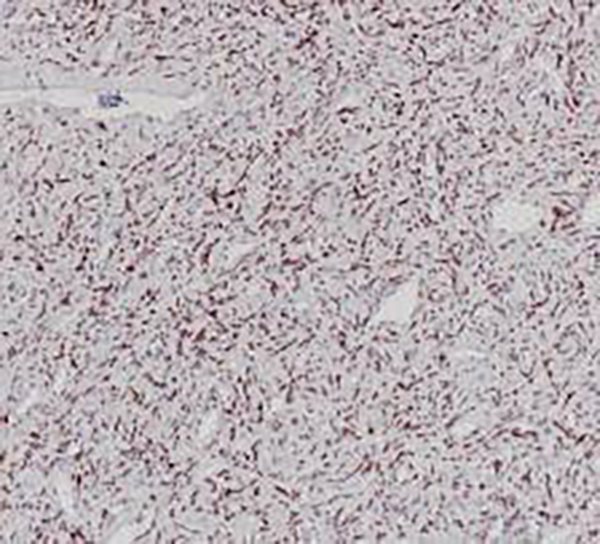 STAT6 Recombinant Rabbit Monoclonal Antibody (clone BP6246)