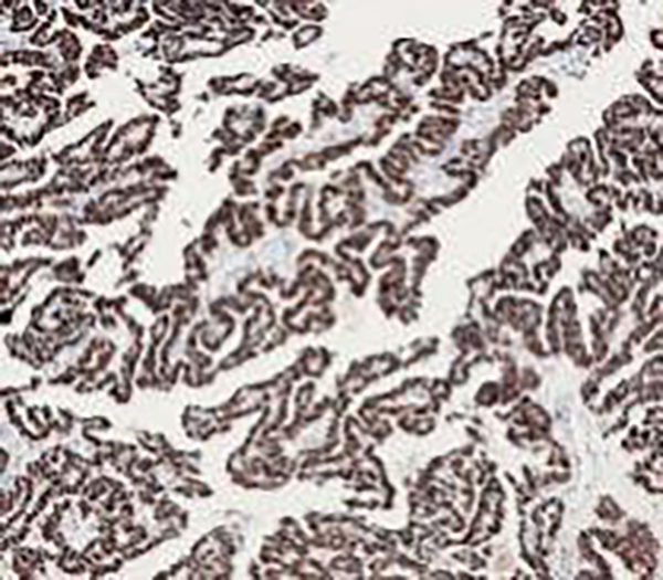 TPO Recombinant Rabbit Monoclonal Antibody (clone BP6071)