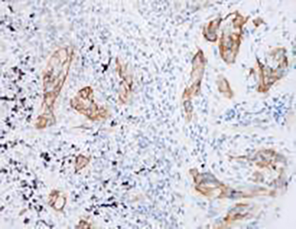 N-Cadherin Recombinant Rabbit Monoclonal Antibody (clone BP6095)