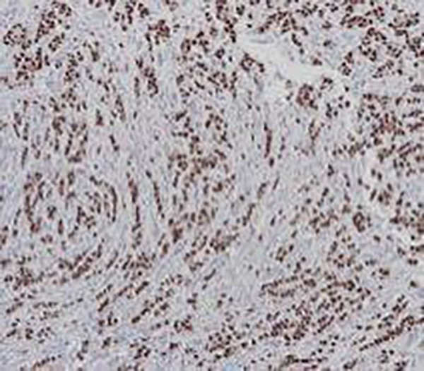 IgM Recombinant Rabbit Monoclonal Antibody (clone BP6135)
