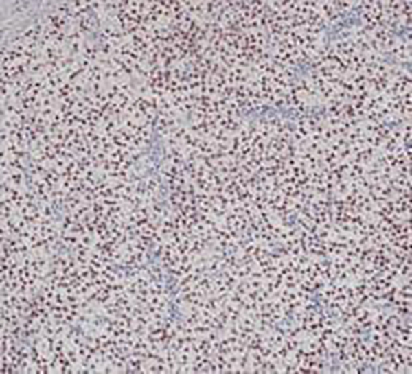 MDM2 Recombinant Rabbit Monoclonal Antibody (clone BP6203)
