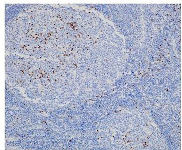 MUM1 Recombinant Rabbit Monoclonal Antibody (clone BP6251)