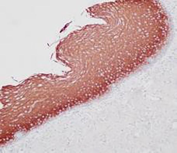 Cyclin D1 Recombinant Rabbit Monoclonal Antibody (clone BP6076)