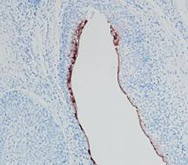 hCG beta Recombinant Rabbit Monoclonal Antibody (clone BP6198)