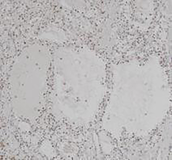 TFE3 Recombinant Rabbit Monoclonal Antibody (clone BP6180)