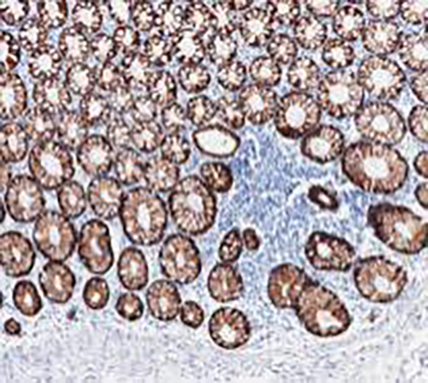 Cytokeratin 8&18 Recombinant Rabbit Monoclonal AntibodyCocktail (clone BP6005/BP6054)