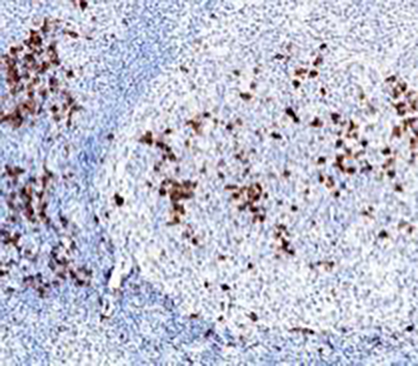 Progesterone Receptor Recombinant Rabbit Monoclonal Antibody (clone BP6081)