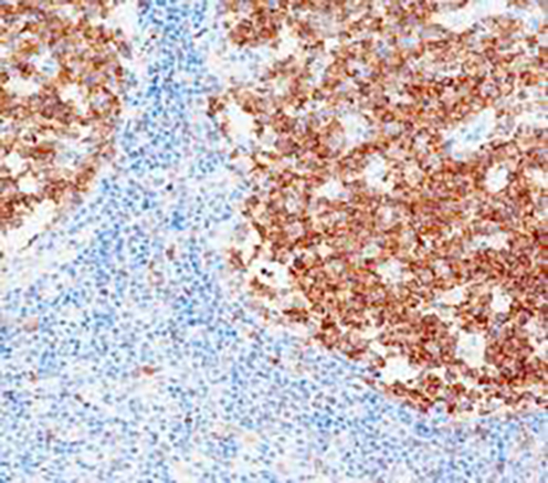 Stathmin Recombinant Rabbit Monoclonal Antibody (clone BP6241)