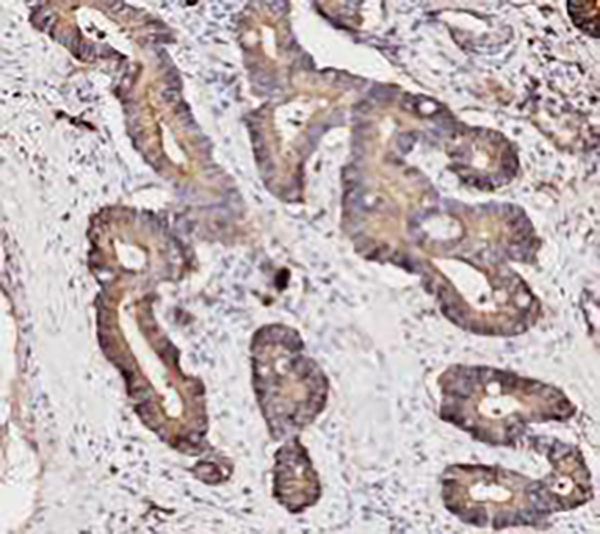 Von Willebrand Factor Recombinant Rabbit Monoclonal Antibody (clone BP6084)