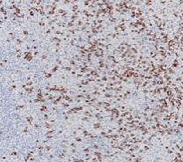 Desmin Recombinant Mouse Monoclonal Antibody (clone D33)