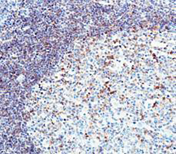 CXCR5 Recombinant Rabbit Monoclonal Antibody (clone BP6239)
