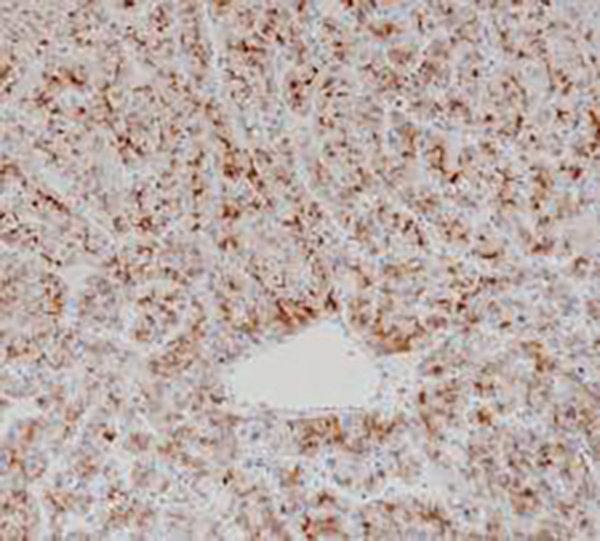 Glypican-3 Recombinant Rabbit Monoclonal Antibody (clone BP6228)