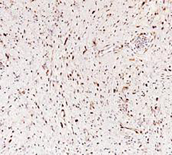 CDK4 Recombinant Rabbit Monoclonal Antibody (clone BP6230)