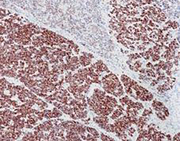 INSM-1 Recombinant Rabbit Monoclonal Antibody (clone BP6240)