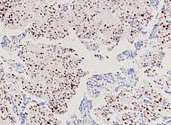 N-Myc Recombinant Rabbit Monoclonal Antibody (clone BP6155)