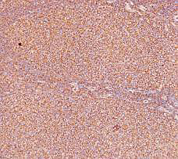MHC I Recombinant Rabbit Monoclonal Antibody (clone BP6234)