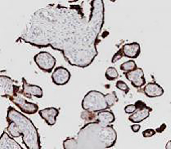 TTF-1 Recombinant Rabbit Monoclonal Antibody (clone BP6079)