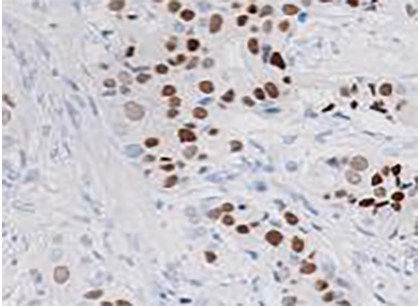 hCG Recombinant Rabbit Monoclonal Antibody (clone BP6080)