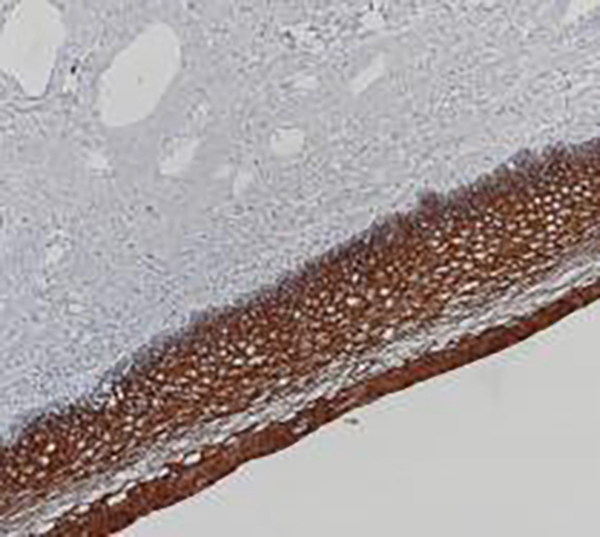 Cytokeratin 5&6 Recombinant Rabbit Monoclonal AntibodyCocktail (clone BP6021/BP6065)