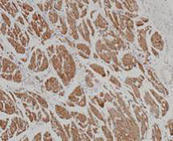 PAX-5 Recombinant Rabbit Monoclonal Antibody (clone BP6140)