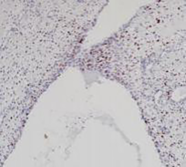 TROP-2 Recombinant Rabbit Monoclonal Antibody (clone BP6208)