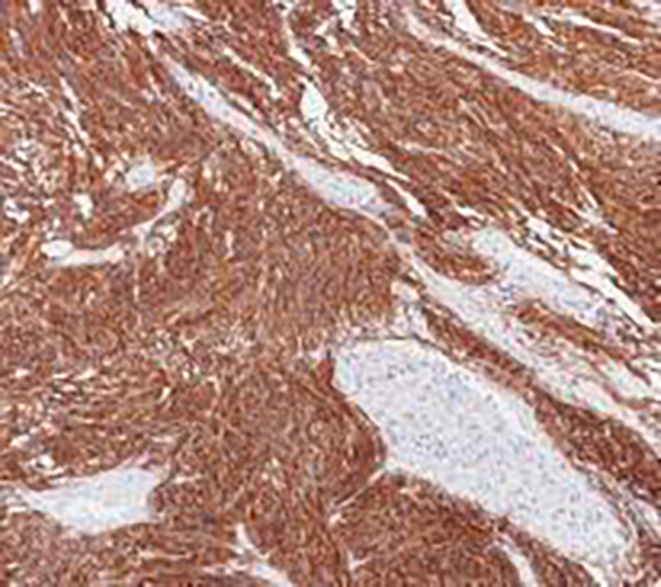 CD163 Recombinant Rabbit Monoclonal Antibody (clone BP6063)