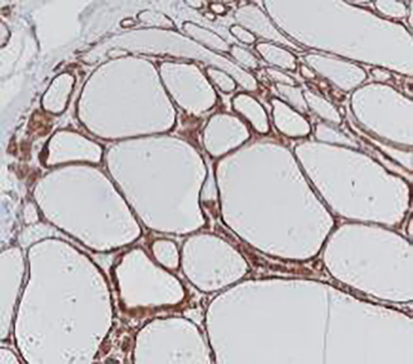 TPO Recombinant Mouse Monoclonal Antibody (clone BPM6183)