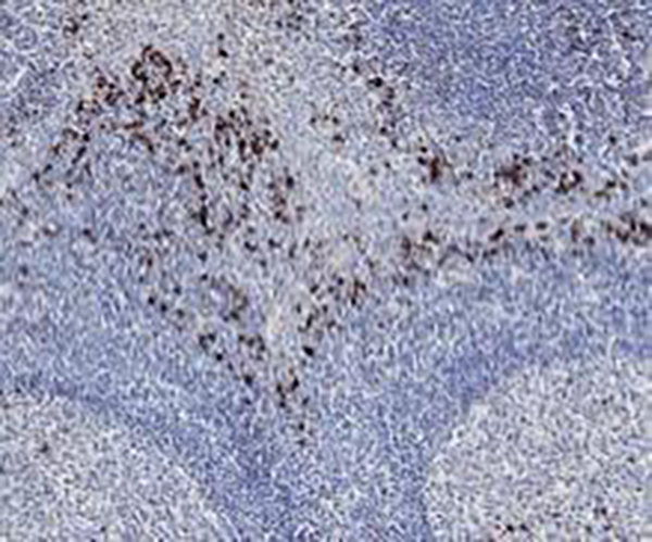 p53 Recombinant Mouse Monoclonal Antibody (clone BPM6168)