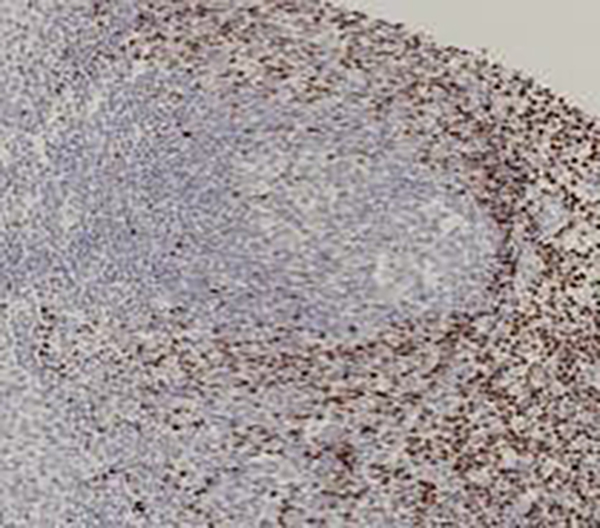 FOXP1 Recombinant Rabbit Monoclonal Antibody (clone BP6112)