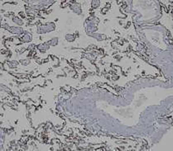 Cytokeratin 17 Recombinant Rabbit Monoclonal Antibody (clone BP6108)