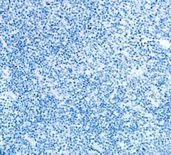 AFP Recombinant Rabbit Monoclonal Antibody (clone BP6244)