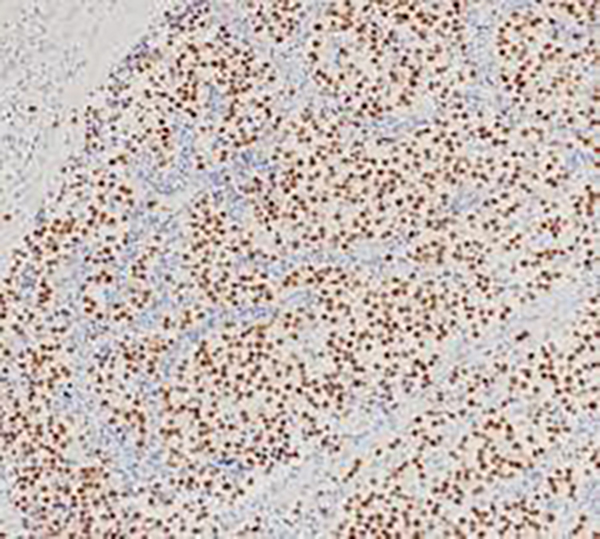 SALL4 Recombinant Rabbit Monoclonal Antibody (clone BP6245)