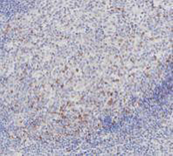 CTLA-4 Recombinant Rabbit Monoclonal Antibody (clone BP6187)