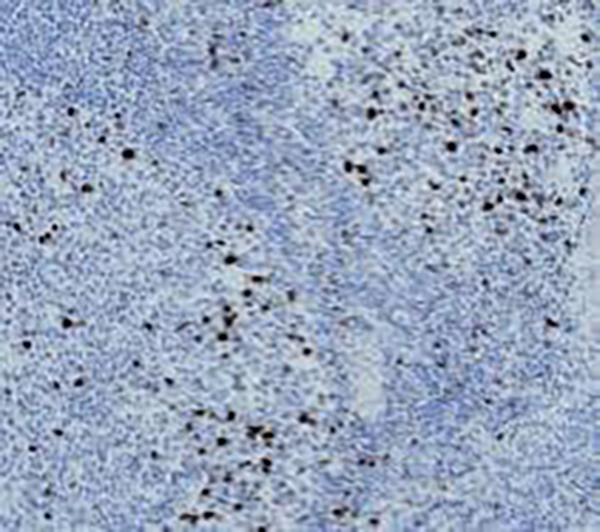 Myosin (Smooth Muscle) Recombinant Rabbit Monoclonal Antibody (clone BP6091)