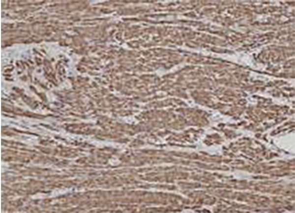 CD5 Recombinant Rabbit Monoclonal Antibody (clone BP6090)