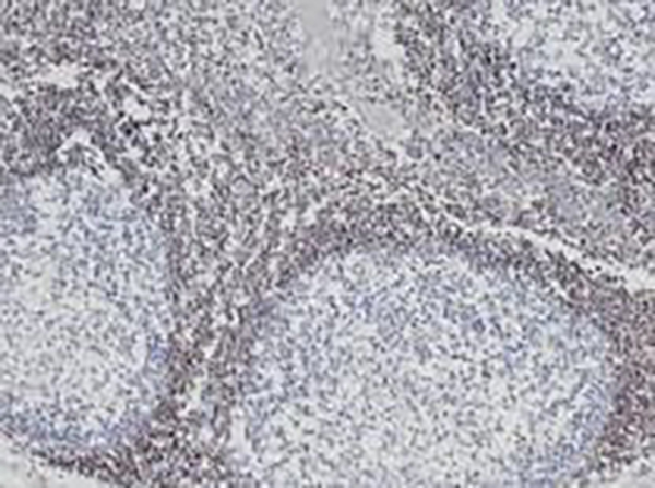 BCL-2 Recombinant Mouse Monoclonal Antibody (clone 8C8)