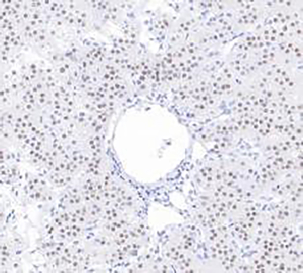SF-1 Recombinant Rabbit Monoclonal Antibody (clone BP6236)