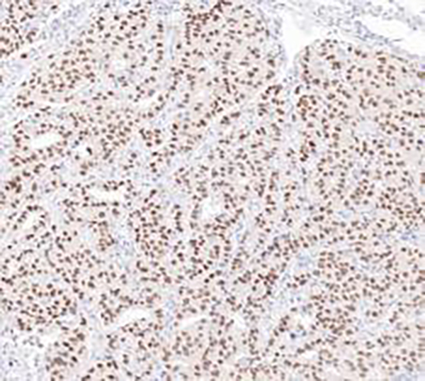 TRPS1 Recombinant Rabbit Monoclonal Antibody (clone BP6231)