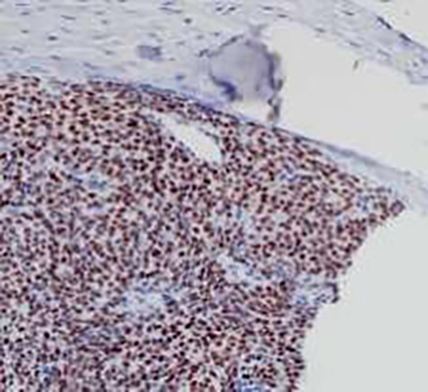 TLE1 Recombinant Rabbit Monoclonal Antibody (clone BP6223)