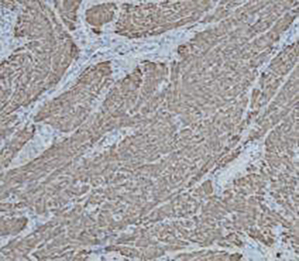 Phosphohistone H3 (PHH3) Recombinant Rabbit Monoclonal Antibody (clone BP6092)