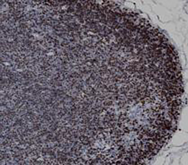 S100 Recombinant Rabbit Monoclonal Antibody (clone BP6088)